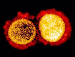 Coronavírus SARS-CoV-2