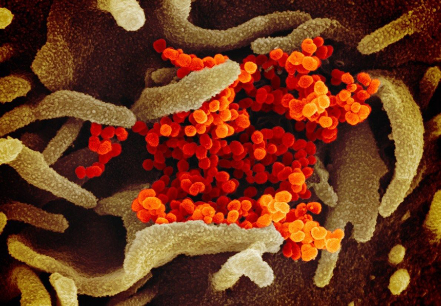 Partículas do vírus SARS-CoV-2