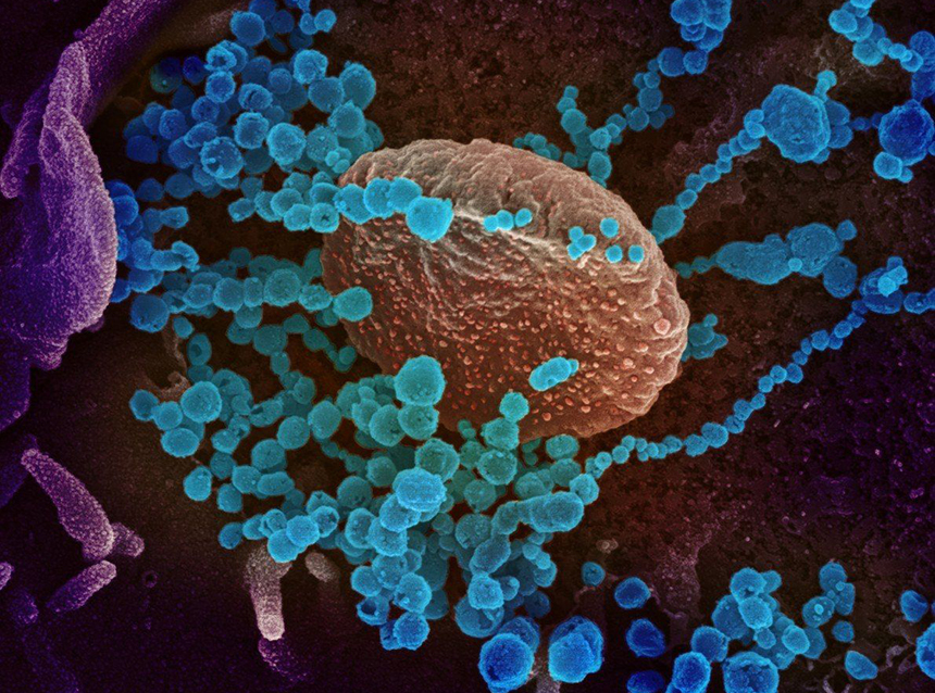 Partículas do vírus SARS-CoV-2 (em azul)